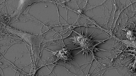 Wenn Zellen aus dem Takt geraten – Einblick in die Ursachen neurodegenerativer Erkrankungen