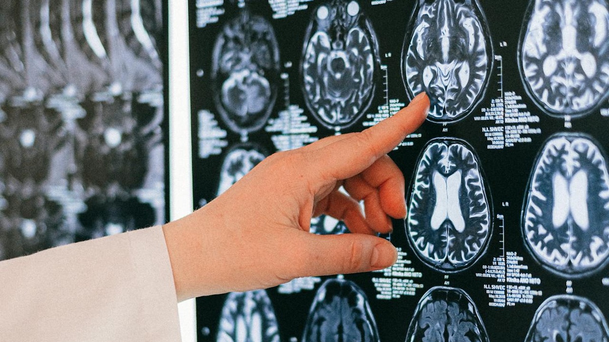 Forschung im Fokus: Künstliche Intelligenz in der medizinischen Bildgebung – wo stehen wir heute und was bringt die Zukunft?