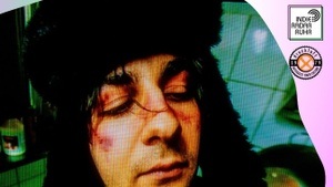 Acidfrank
