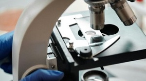 Pint of Science: Das Unsichtbare verstehen: Von Pilzen, Mikroben und alten Kulturen