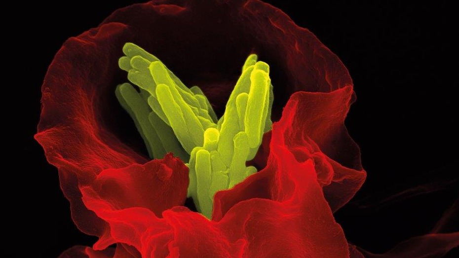 Pest, Malaria und neue Erreger – Kampf gegen Infektionskrankheiten in Vergangenheit und Gegenwart