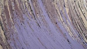 Reinhard Brunner „Bewegungsmuster”